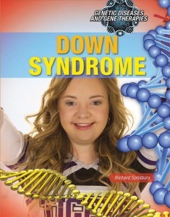 Down syndrome  Cover Image