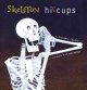Go to record Skeleton hiccups