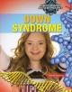 Go to record Down syndrome